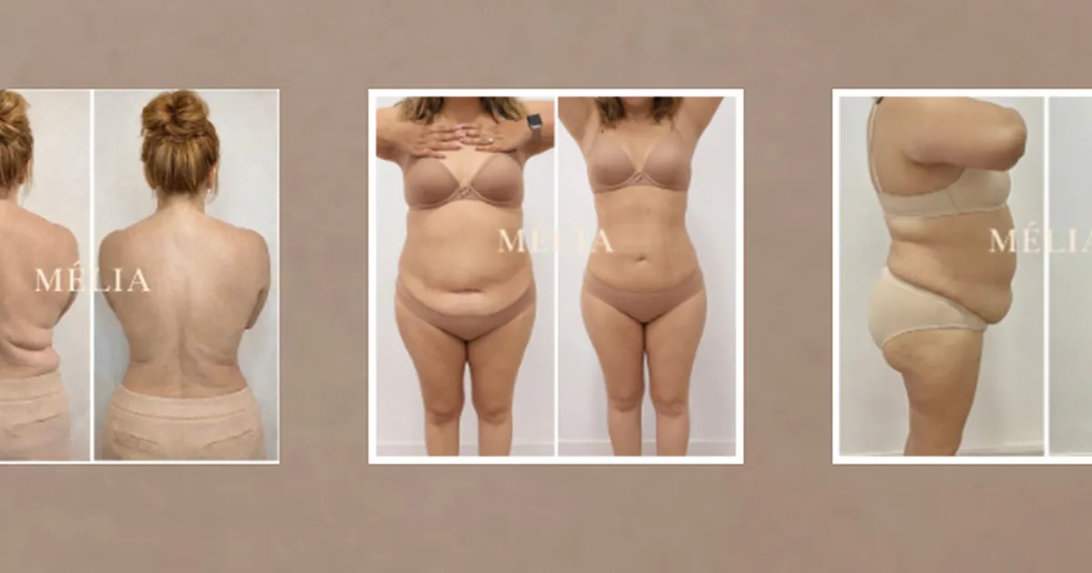 MELIA Beauty Clinic