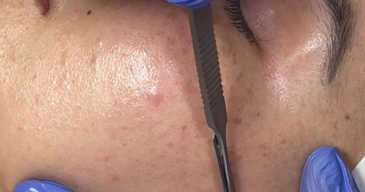 Ferco Spa