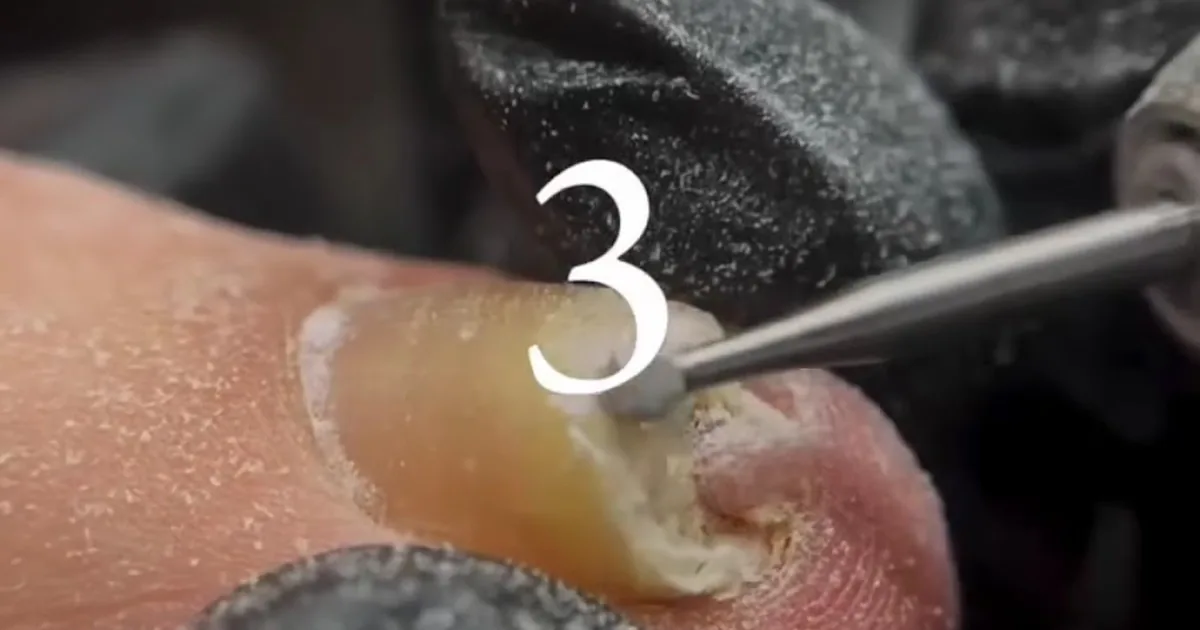 MASAJES|JESUSMARIOMASOTERAPEUTA