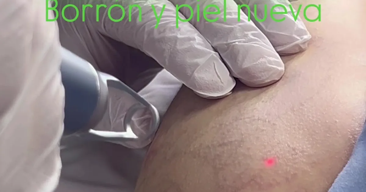 Rocio García Dermocosmiatria Clinica
