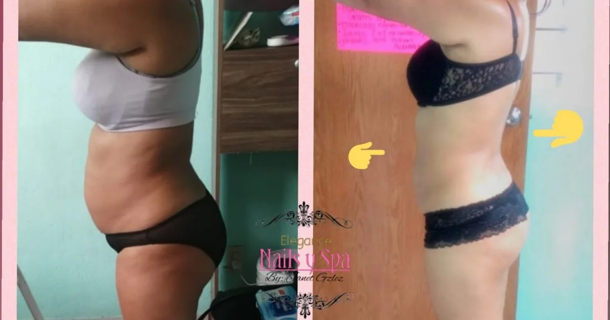 Spa y reductivos