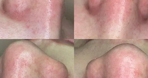 Erandy spa, negocios en Tlaquepaque, Jalisco