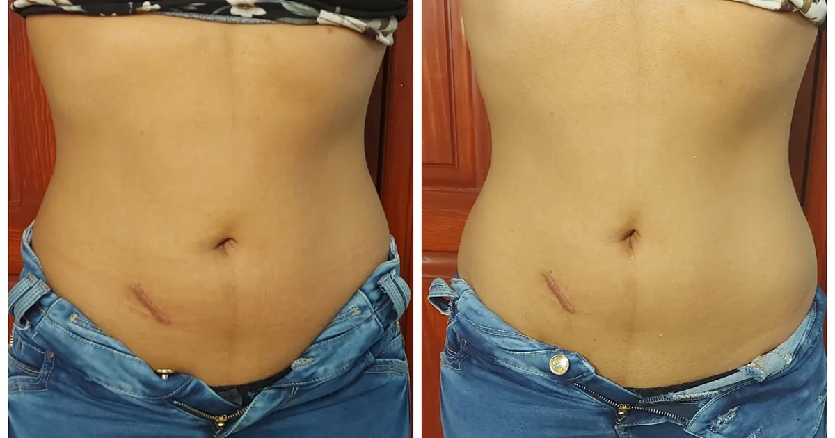 Shalom Spa (Consultorio nutricional y estética corporal & facial)