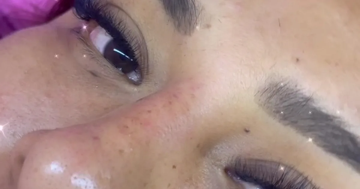 Estética Nuevas Formas