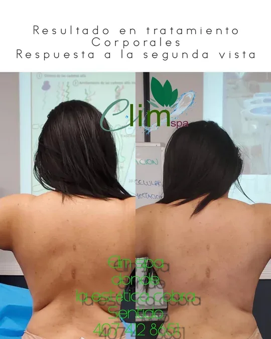 Elim Spa · foto 3