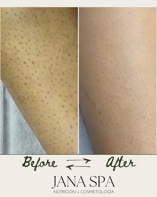 JANA SPA · foto 3