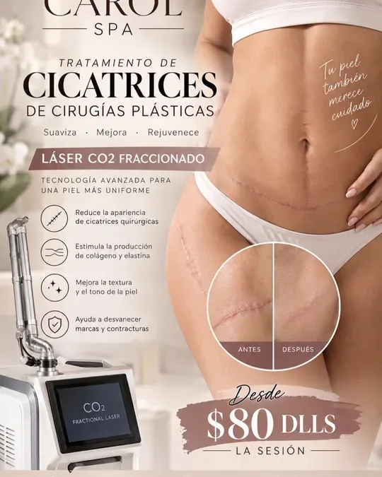 Carol Spa · foto 2