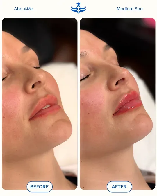 About Me Medical Spa · foto 4
