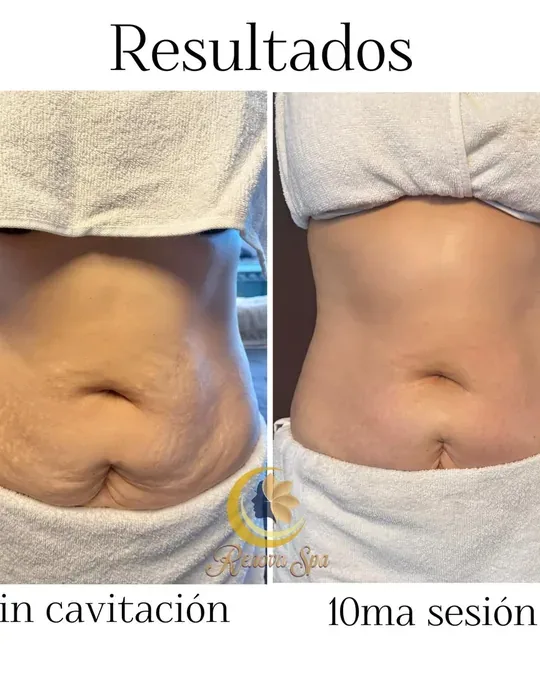 Renova Spa · foto 1