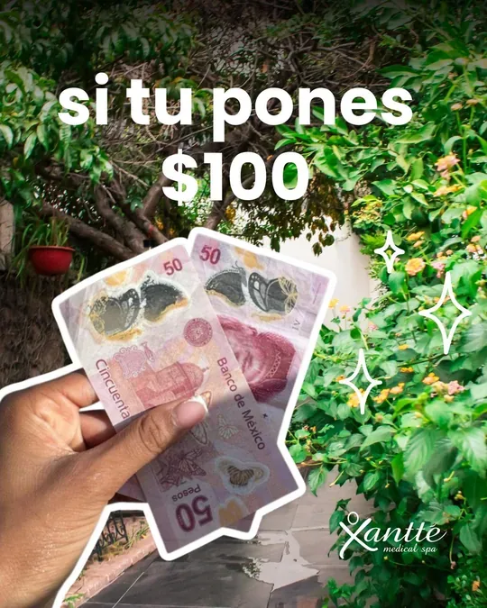 Xantté · foto 1