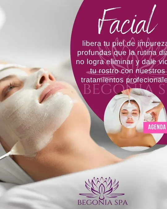 Begonia Spa · foto 2
