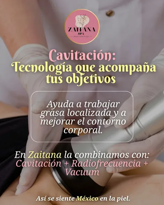 Zaitana SPA · foto 3