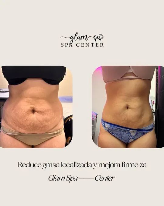 Glam Spa Center · foto 4