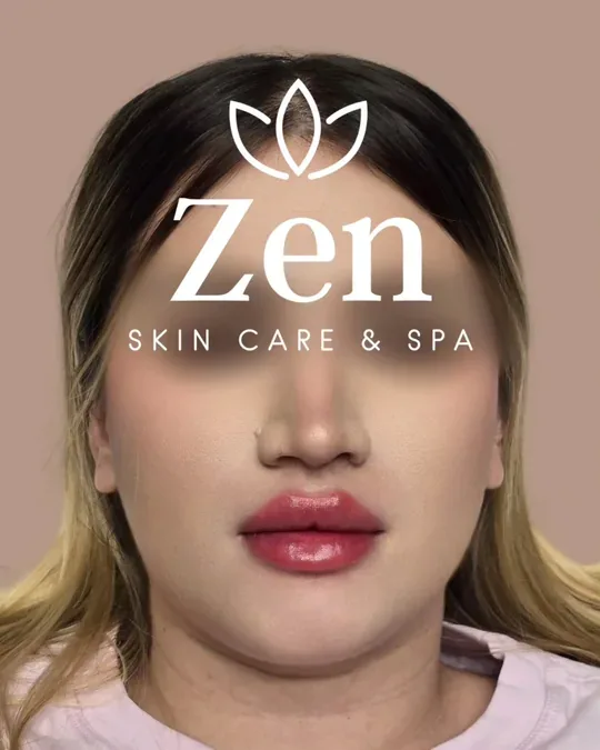 ZEN SKIN CARE & SPA · foto 1
