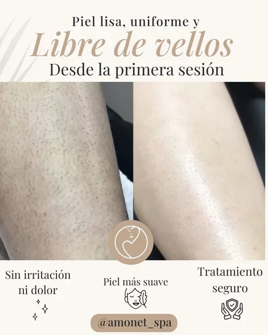 Amonet Spa · foto 2