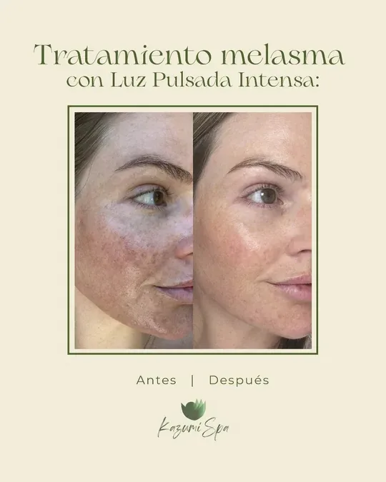 KazumiSpa · foto 2