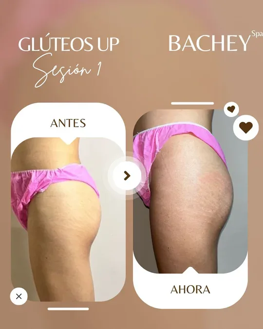 Bachey_spa · foto 1