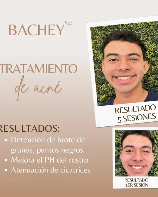 Bachey_spa · foto 3