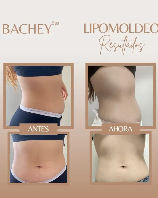 Bachey_spa · foto 4