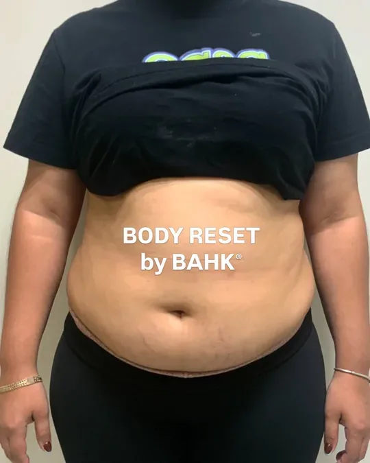 BAHK® Science Based Beauty · foto 2