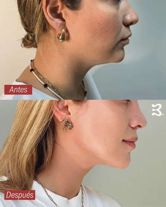 BAHK® Science Based Beauty · foto 3