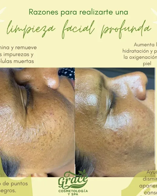 Grace Cosmetologia y Spa · foto 1