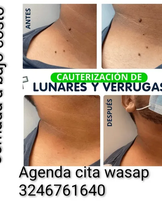 Bellas Spa · foto 1