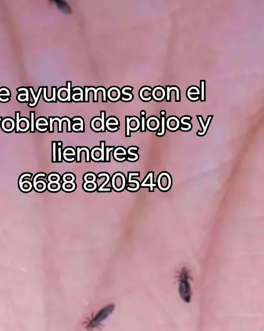 Lice Away Spa · foto 4