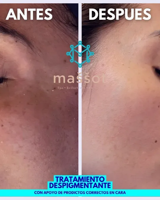 Massot spa · foto 1