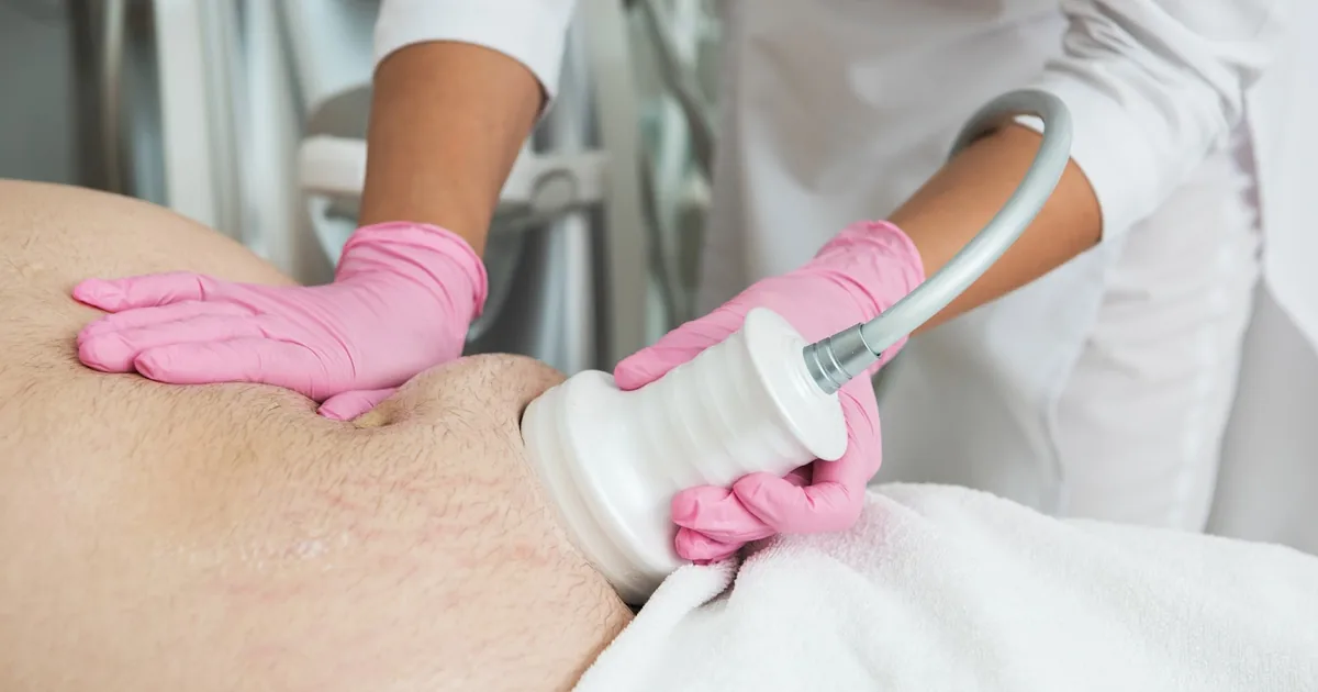 Cavitación y Mesoterapia – SPA en Hermosillo