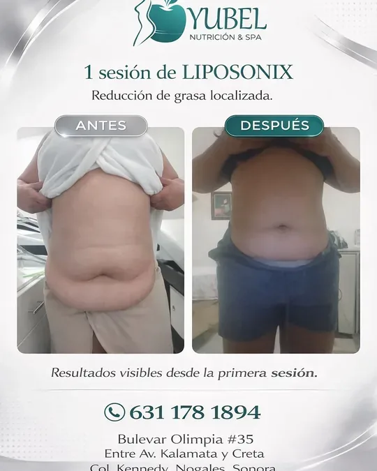 YUBEL Clínica-SPA · foto 3