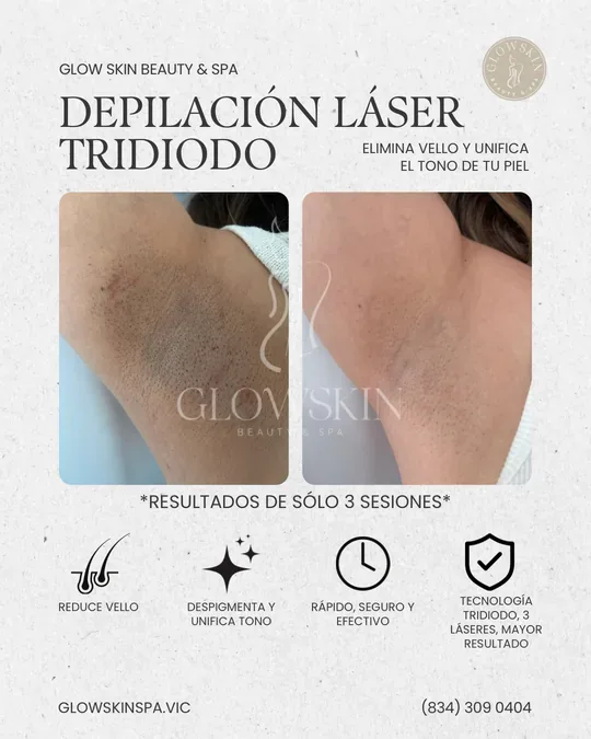 Glow Skin Beauty & Spa · foto 3