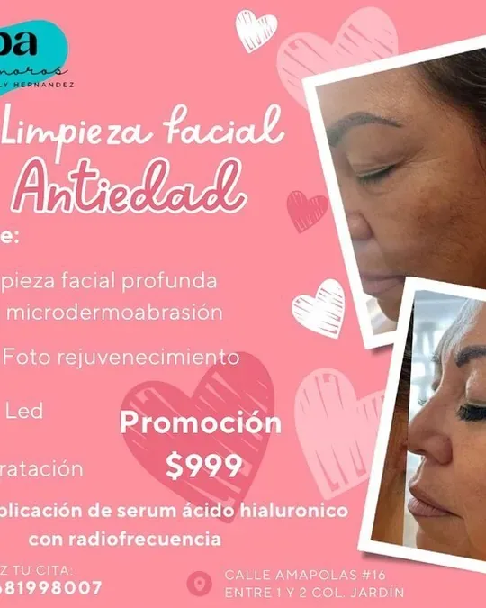 Spa Matamoros · foto 4