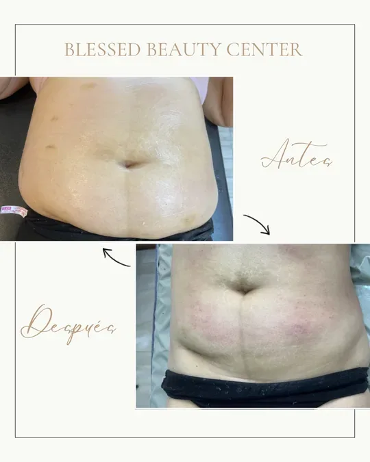 Blessed Beauty Center · foto 2