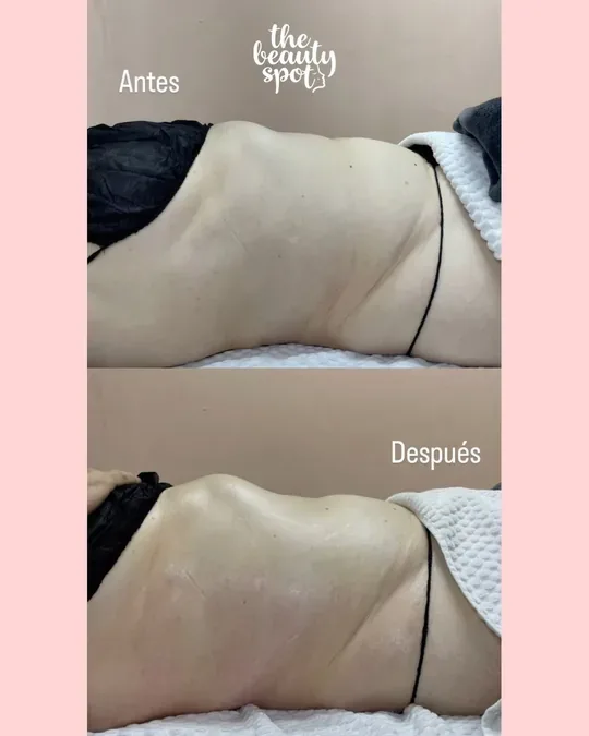 The Beauty Spot · foto 3