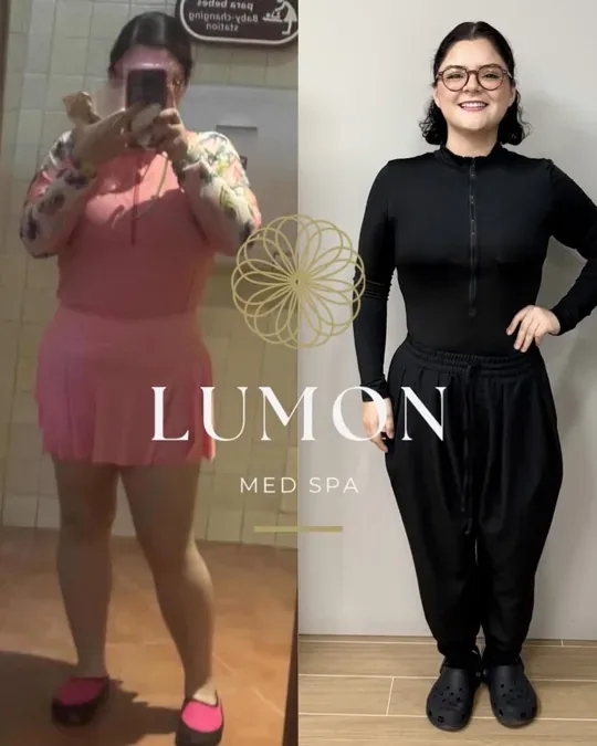 LUMON MED SPA · foto 4
