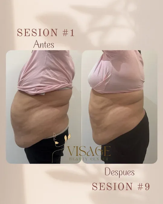 Visage Beauty Center · foto 4