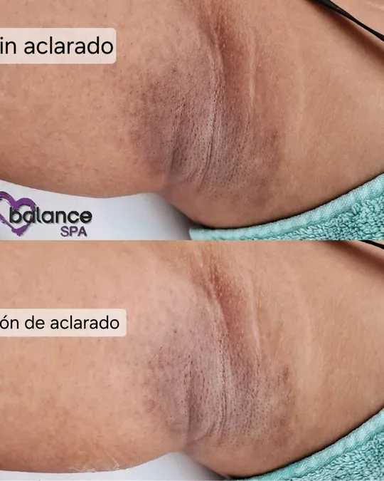 Balance Spa · foto 2