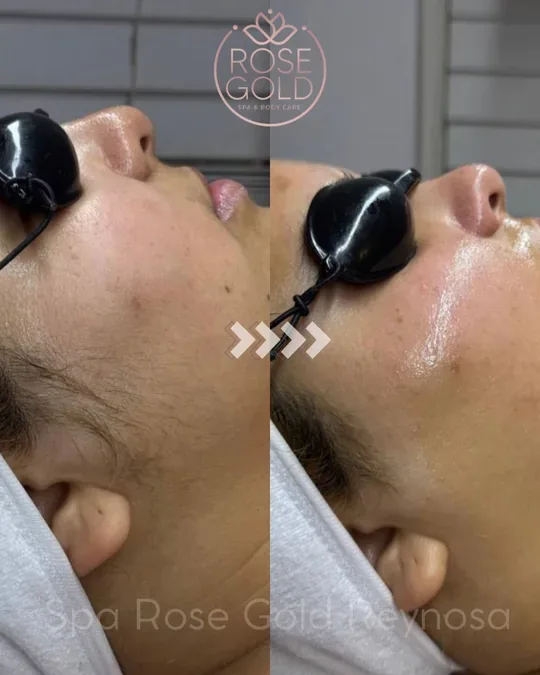 Angelus beauty Spa · foto 4