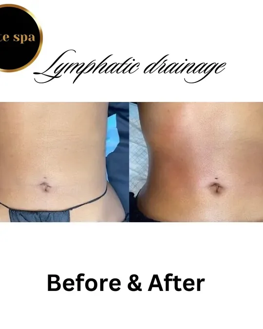 Elite Spa · foto 4