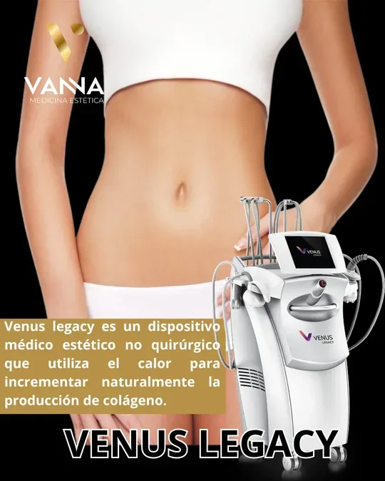 VANNA · foto 1