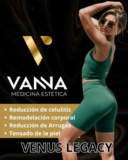 VANNA · foto 2
