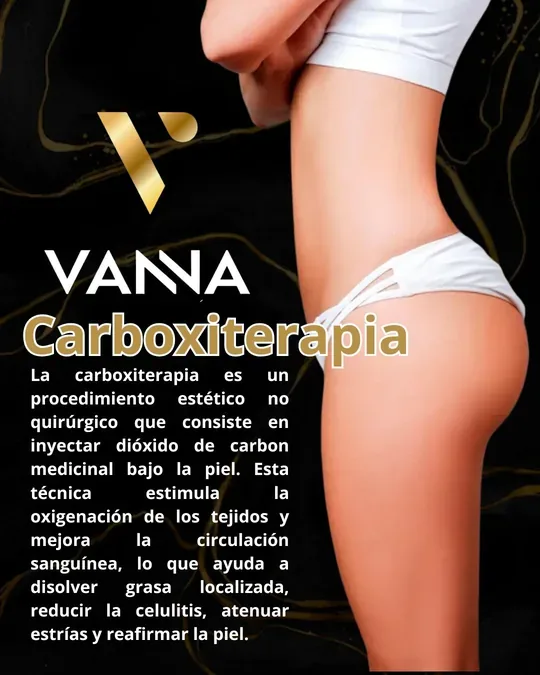 VANNA · foto 4