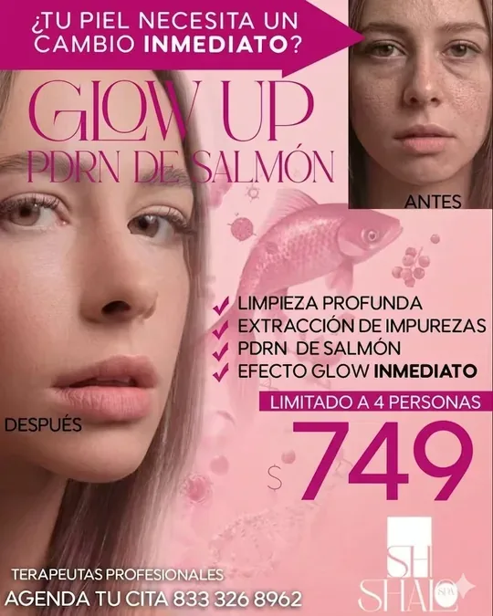 SHALO SPA · foto 1