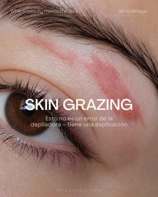 Impeccable Skin · foto 4