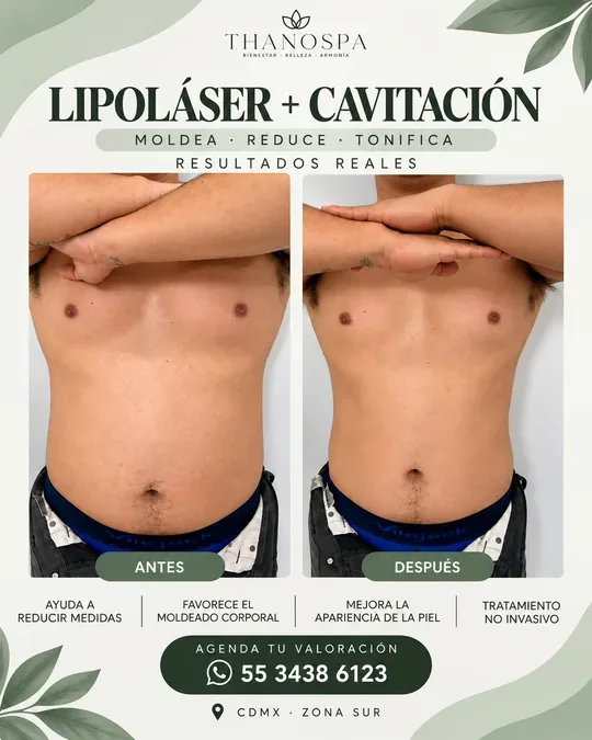 ThanoSpa · foto 2