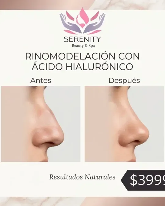 Serenity Beauty Spa Azcapotzalco · foto 3