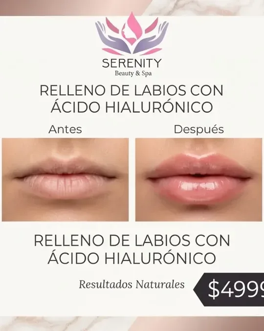 Serenity Beauty Spa Azcapotzalco · foto 4