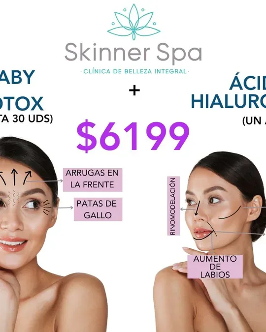 Skinnerspa · foto 2