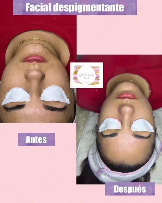 GLOW DAY SPA · foto 4
